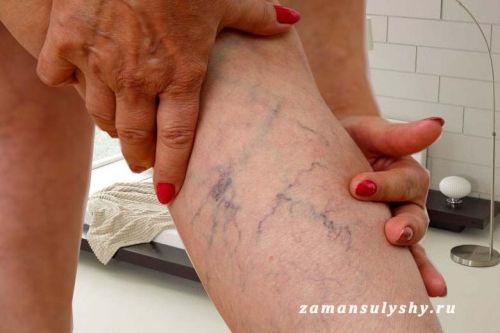 Как избежать ночных судорог в ногах и наконец-то выспаться