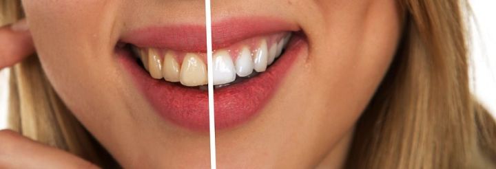 Чтобы зубы были целы: Вещи, которые стоматологи никогда не потянут в рот