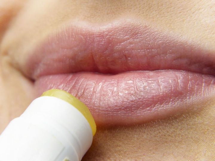 10 домашних рецептов для обветренных губ, которые избавят от проблемы всего за сутки
