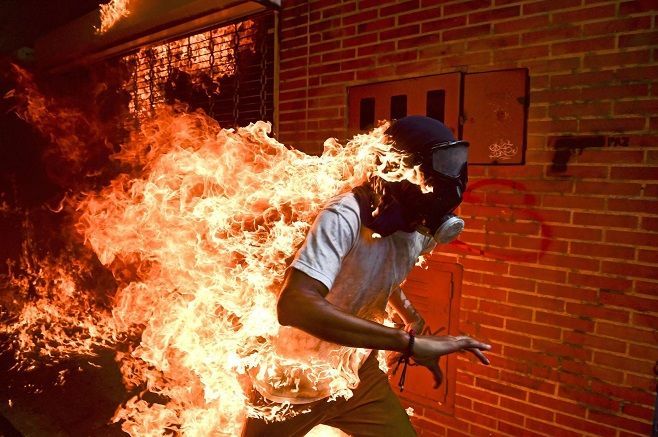 Фото с горящим венесуэльцем признано лучшим в мире