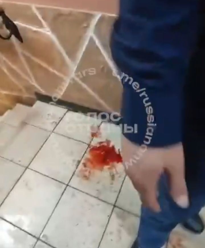 В Лениногорске жестоко избили многодетного отца
