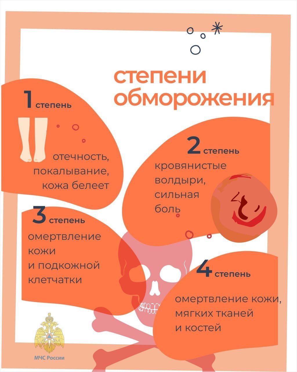 Как избежать обморожения: советы от МЧС России