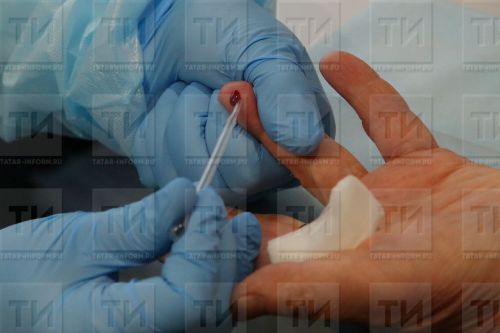 В Лениногорском районе в 2024 году погибло 32 ВИЧ-инфицированного человека