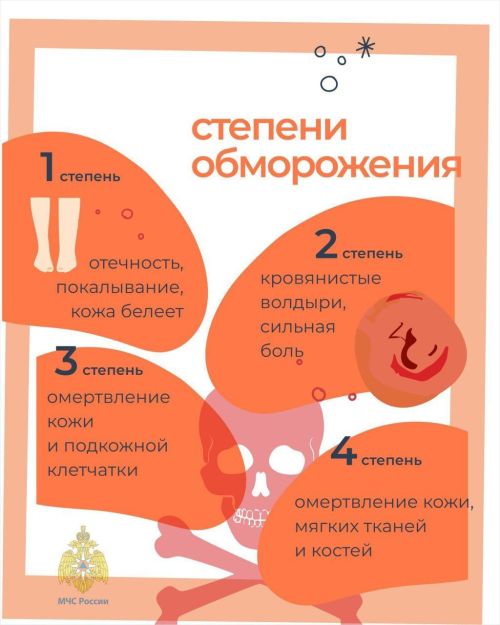 Как избежать обморожения: советы от МЧС России